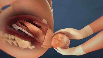 The Stages of Labor 3rd Edition: A Visual Guide | InJoy Health Education